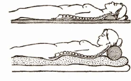 Slika osteohondroze